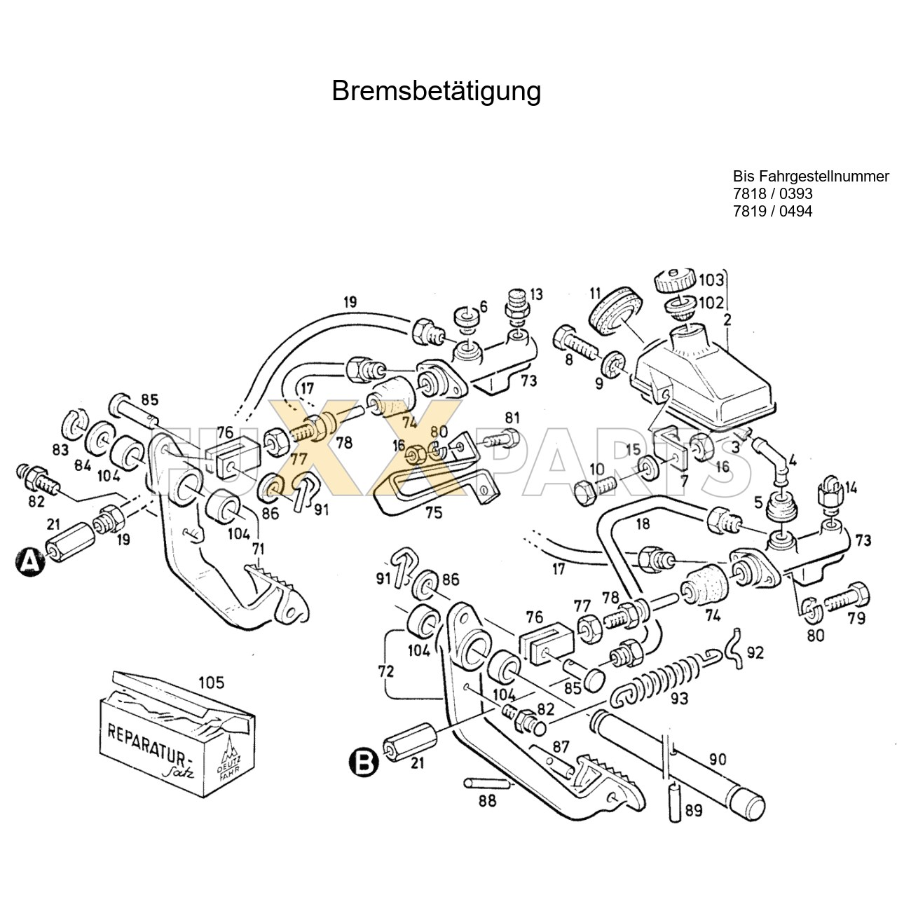 DX 90-78XX Bremsbetätigung 1